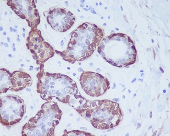 Calponin CNN1 Rabbit Monoclonal Antibody