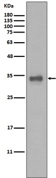 Anti-Calponin CNN1 Rabbit Monoclonal Antibody