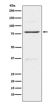 Insulin Receptor R INSRR Rabbit Monoclonal Antibody