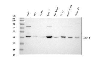 Anti-SOX1 Rabbit Monoclonal Antibody