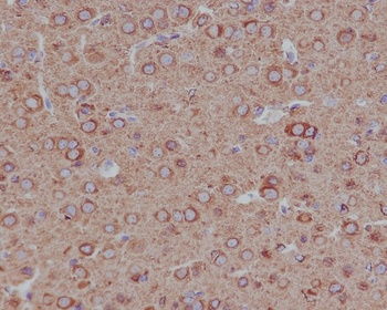 Anti-beta II Tubulin Rabbit Monoclonal Antibody