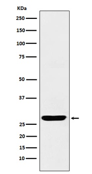SCGN Rabbit Monoclonal Antibody