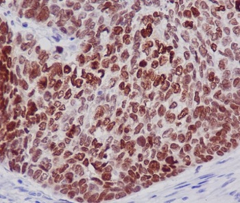 Histone H2B Rabbit Monoclonal Antibody