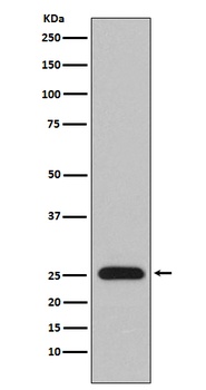 Lambda Light chain IGLV1-51 Monoclonal Antibody