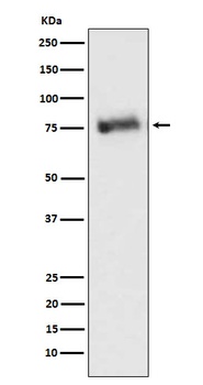 GRK3 Rabbit Monoclonal Antibody