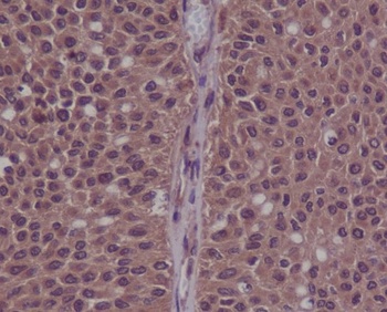 Phospho-CDK2 (Y15) Rabbit Monoclonal Antibody