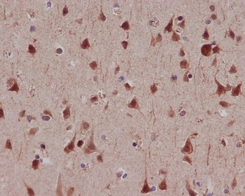 Phospho-MSK1 (S376) RPS6KA5 Monoclonal Antibody
