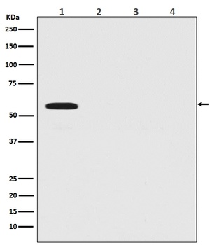 Firefly Luciferase Rabbit Monoclonal Antibody