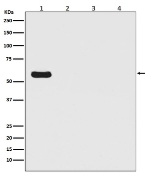 Firefly Luciferase Rabbit Monoclonal Antibody