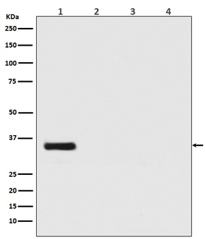 Renilla Luciferase Rabbit Monoclonal Antibody