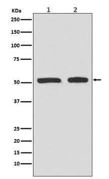 Phospho-p53 (S9) TP53 Rabbit Monoclonal Antibody