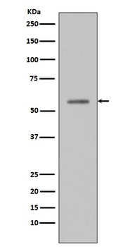 Phospho-p53 (S33) TP53 Rabbit Monoclonal Antibody