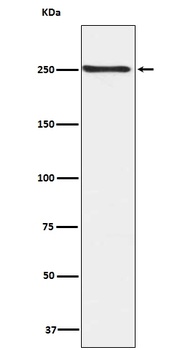 Phospho-mTOR (S2448) Rabbit Monoclonal Antibody