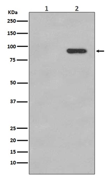 Phospho-beta Catenin (S33/S37) CTNNB1 Rabbit Monoclonal Antibody