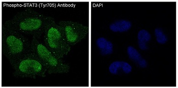 Anti-Phospho-STAT3 (Y705) Rabbit Monoclonal Antibody