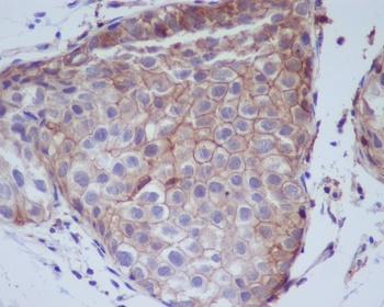 Phospho-EGFR (Y1092) Rabbit Monoclonal Antibody