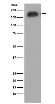 Phospho-EGFR (Y1092) Rabbit Monoclonal Antibody