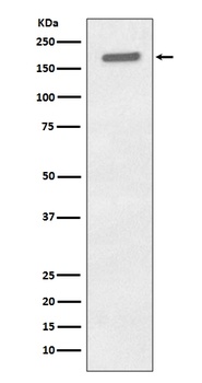 Phospho-EGFR (Y1197) Rabbit Monoclonal Antibody