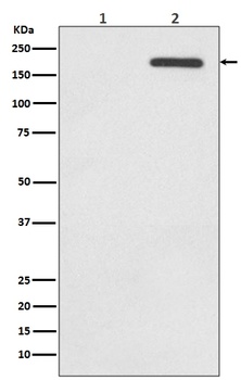 Phospho-EGFR (Y1092) Rabbit Monoclonal Antibody