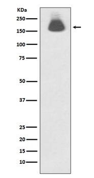 Phospho-EGFR (S695) Rabbit Monoclonal Antibody