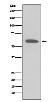 Phospho-Akt (Ser473) AKT1 Rabbit Monoclonal Antibody