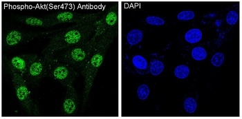 Phospho-Akt (Ser473) AKT1 Rabbit Monoclonal Antibody