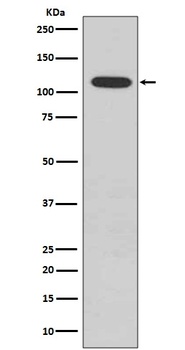 Anti-Phospho-Rb (S807) RB1 Rabbit Monoclonal Antibody