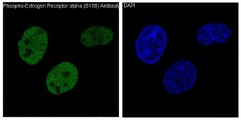 Anti-Phospho-ER alpha (S118) ESR1 Rabbit Monoclonal Antibody