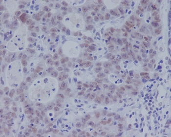 Phospho-Smad3 (S423 + S425) Rabbit Monoclonal Antibody