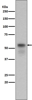 Anti-Phospho-Smad3 (S423 + S425) Rabbit Monoclonal Antibody