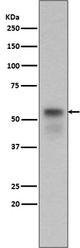 Phospho-Smad3 (S423 + S425) Rabbit Monoclonal Antibody