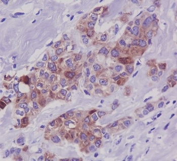 Anti-Phospho-Tau (S396) MAPT Rabbit Monoclonal Antibody