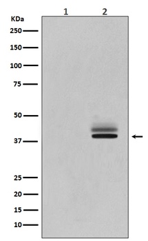 Phospho-Erk1 (T202/Y204) + Erk2 (T185/Y187) MAPK3 Rabbit Monoclonal Antibody