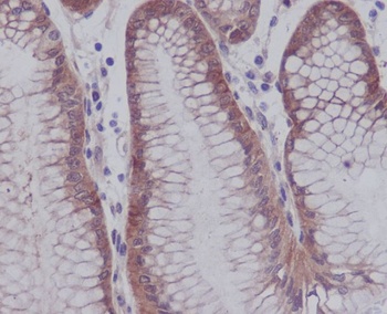 Phospho-YAP1 (S127) Rabbit Monoclonal Antibody