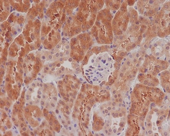 Phospho-eIF4E (S209) Rabbit Monoclonal Antibody