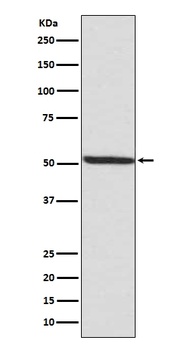 Phospho-IRF3 (S386) Rabbit Monoclonal Antibody