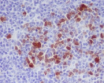 Phospho-Cdk1/2 (T14) Rabbit Monoclonal Antibody