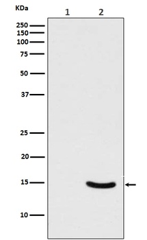 Phospho-alpha Synuclein (S129) SNCA Rabbit Monoclonal Antibody