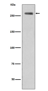 Phospho-LRRK2 (S935) Rabbit Monoclonal Antibody