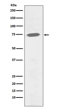 Phospho-BTK (Y551) Rabbit Monoclonal Antibody