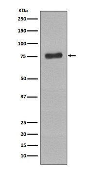 Phospho-BTK (Y223) Rabbit Monoclonal Antibody
