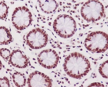 Anti-Phospho-DNA PKcs (S2056) PRKDC Rabbit Monoclonal Antibody