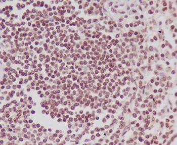 Anti-Phospho-POLR2A (S5) Rabbit Monoclonal Antibody