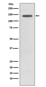 Phospho-TrkB (Y817) NTRK2 Rabbit Monoclonal Antibody