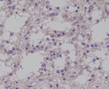 Phospho-TrkB (Y817) NTRK2 Rabbit Monoclonal Antibody