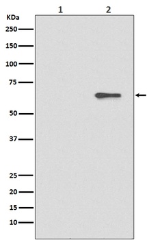 Phospho-AMPK alpha 2 (S491) PRKAA2 Rabbit Monoclonal Antibody
