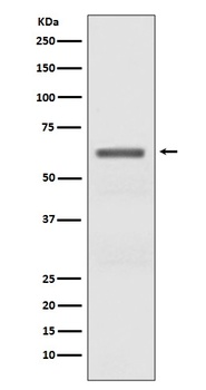 Phospho-AMPK alpha (T172) PRKAA2 Rabbit Monoclonal Antibody