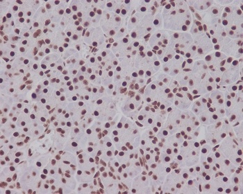 Phospho-Smad5 (S463/465) Rabbit Monoclonal Antibody