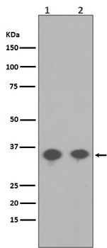 Phospho-PP2A alpha (Y307) PPP2CA Rabbit Monoclonal Antibody