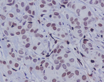 Anti-Phospho-c-Jun (S63) Rabbit Monoclonal Antibody